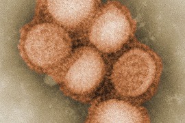 29. April 2009: Schweinegrippe ausgebrochen